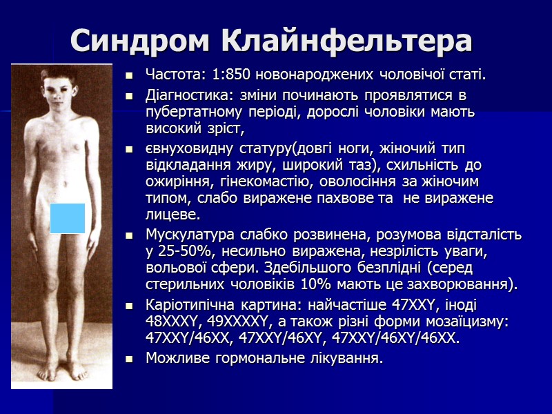 Синдром Клайнфельтера Частота: 1:850 новонароджених чоловічої статі. Діагностика: зміни починають проявлятися в пубертатному періоді,